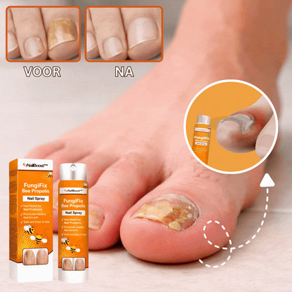 NailBoost™ |Til misfarvede og fortykkede negle